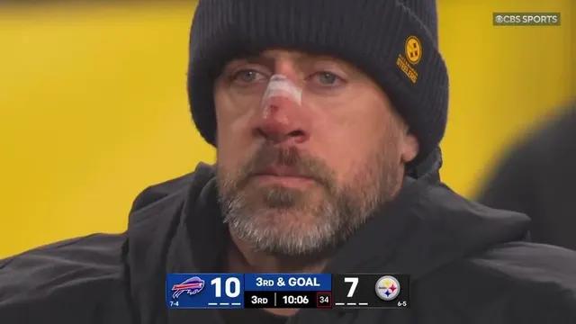 Aaron Rodgers Bloody Nose Reaction meme template