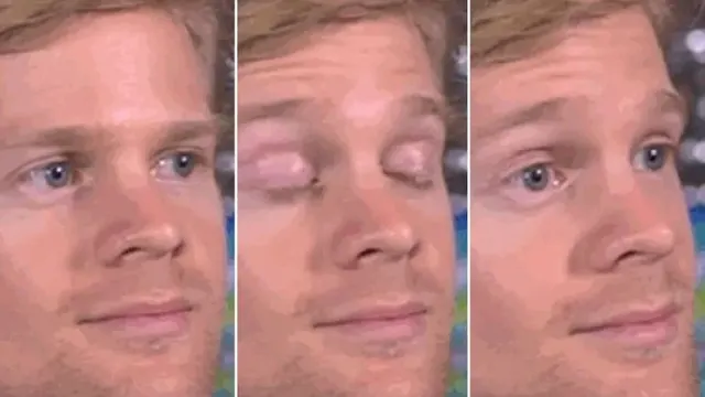 White Guy Blinking meme template